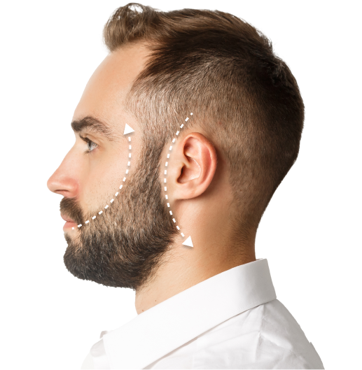 https://clinoraclinic.ghayatltd.com/wp-content/uploads/2026/06/materials/beard- transplant/fue-beard-transplant3.png.webp